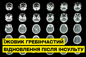 Відновлення після інсульту з Їжовиком гребінчастим фото