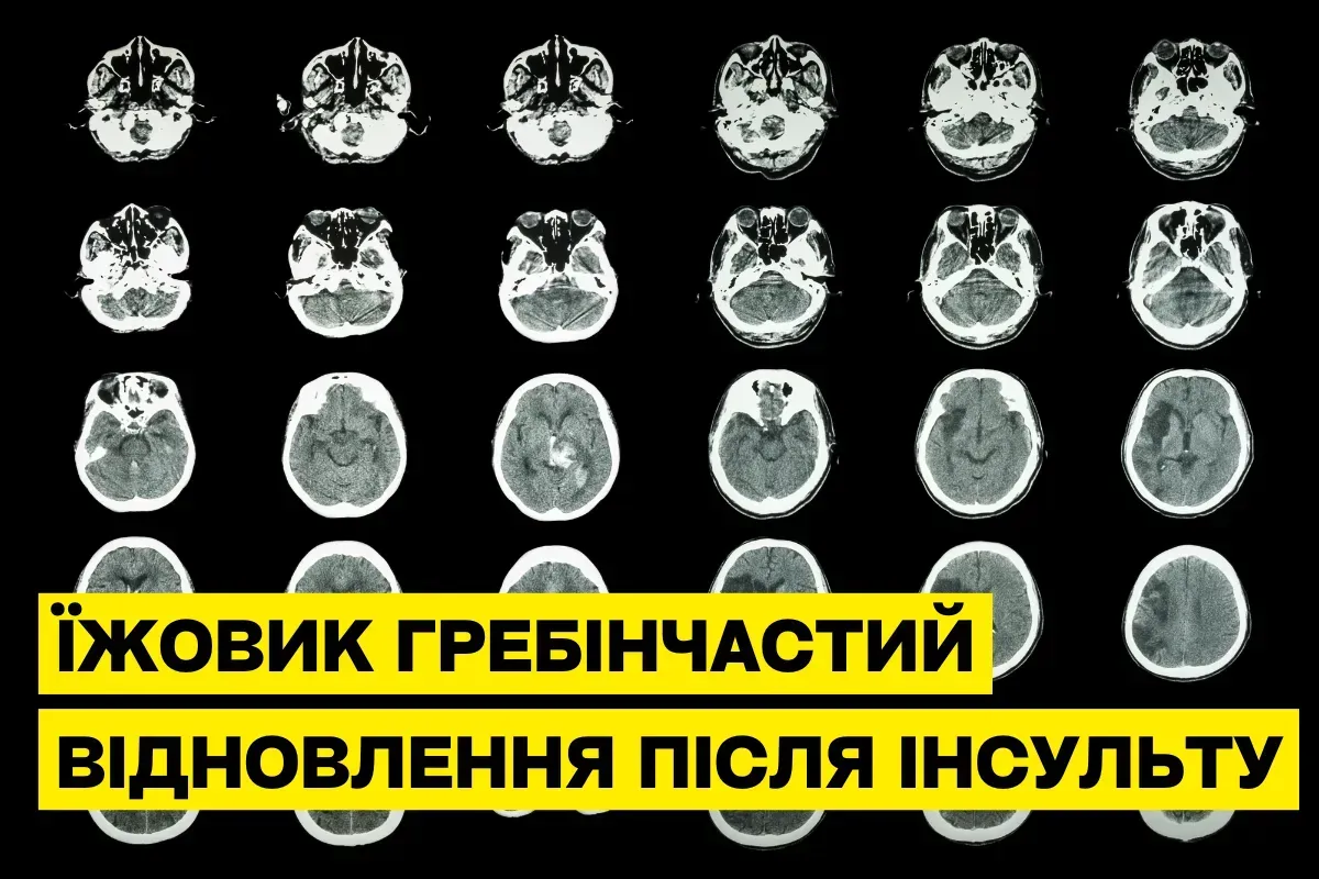 Ежовик гребенчатый для восстановления после инсульта: научные доказательства и рекомендации
